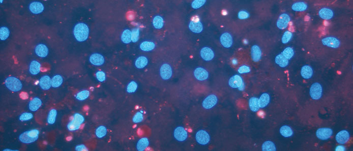 Darstellung apoptotischer Zellkerne