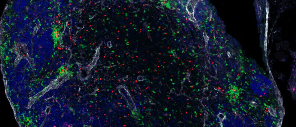 Photo Microskop Immunology Systems immunology Reseach Würzburg