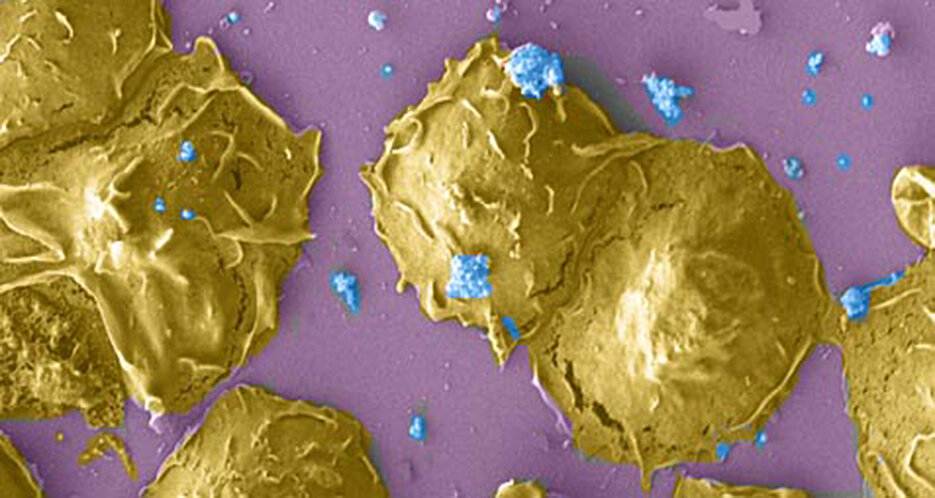 Polymorph-nukleare Leukozyten infiziert mit Chlamydia trachomatis (hier blau gefärbt). (Foto: Karthika Rajeeve)