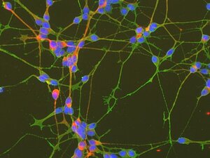 Zellen nach 6 Tagen neurogener Differenzierung