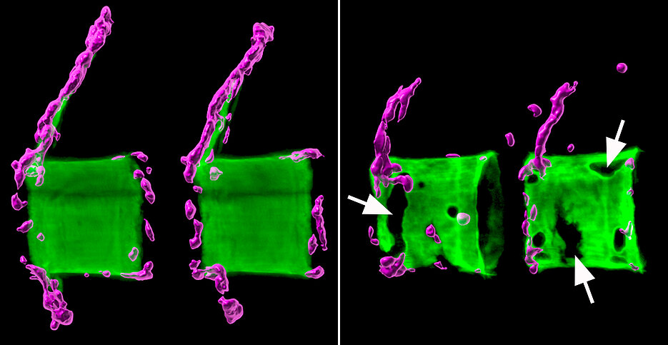 Links zwei gesunde Wirbelkörper aus der Wirbelsäule eines Medaka-Fisches: Die Knochenmatrix (grün) ist normal mineralisiert und von knochenbildenden Zellen (magenta) umgeben. Rechts die Situation bei einem osteoporotischen Fisch.