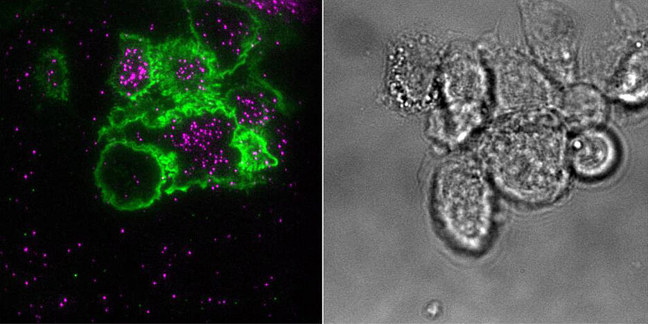 Primäre Myelom-Zellen in der Bildgebung: Links in der totalreflexionsfluoreszenzmikroskopischen Darstellung von zwei Oberflächenmarkern, rechts als Durchlichtmikroskopie-Bild.