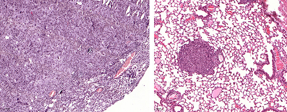 Links ein Lungentumor, der USP28 exprimiert. Rechts dagegen Tumore, in denen USP28 mittels Genschere „ausgeschnitten“ wurde – sie sind deutlich kleiner. Der Größenbalken befindet sich links am Bildrand.