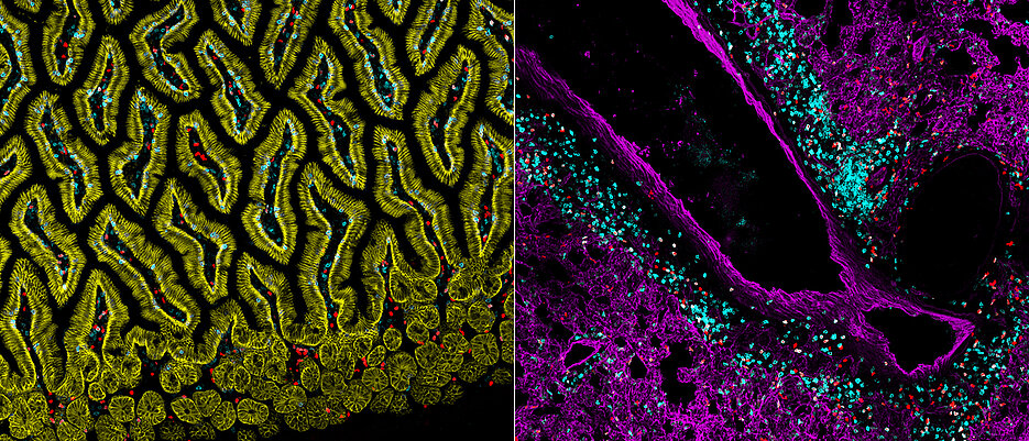 Würzburger Wissenschaftler erforschen Immunzellen in verschiedenen Geweben, hier zum Beispiel ILC2s (rot) oder T-Zellen (blau) in der Lunge (rechts) oder in der Schleimhaut des Dünndarms (links).
