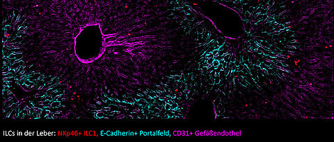 Lebergewebe mit angeborenen Immunzellen (ILCs), hier als rote Punkte sichtbar gemacht.