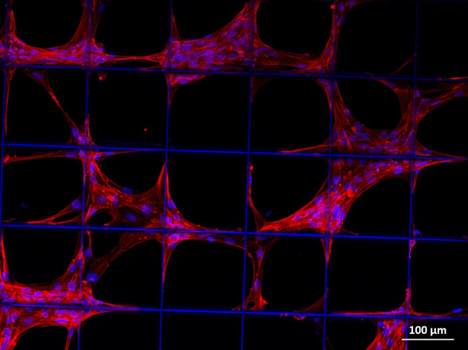 Vorläuferzellen des Stütz- und Bindegewebes (z.B. Knochen, Knorpel, Muskel, Bändern, Sehnen) auf einem Konstrukt aus biologisch abbaubarem Kunststoff (Quelle: Universitätsklinikum Würzburg)