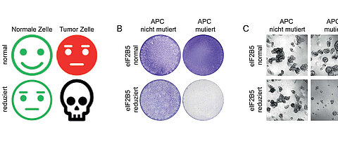 Wird das Gen elF2B5 gehemmt, bekommt das Darmkrebszellen mit einer APC-Mutation nicht gut: Sie sterben ab. Links eine schematische Darstellung, in der Mitte Zellkulturen, rechts Organoide.