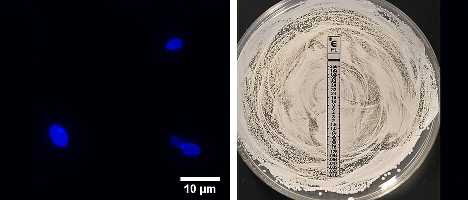 Infektionen mit Candida auris sind schwer zu behandeln und potenziell lebensbedrohlich. Im Bild zu sehen sind links Hefezellen von C. auris und rechts ein Fluconazol-resistenter C. auris Stamm.