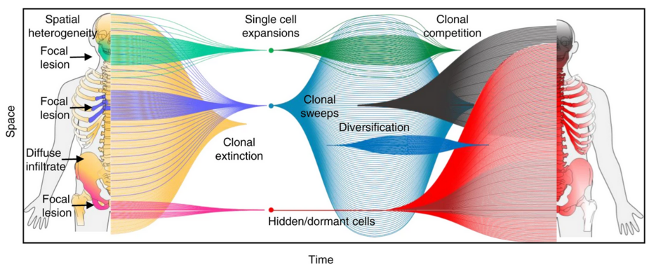 Summary of the spatial-temporal evolution of multiple myeloma