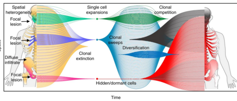 Summary of the spatial-temporal evolution of multiple myeloma