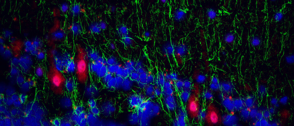 Immunfluoreszenzaufnahme aus der Kleinhirnrindenregion von bipolaren Patienten, die Proteine von humanen Herpesviren in Purkinje-Neuronen zeigen.