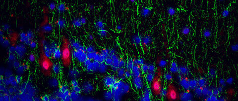 Immunfluoreszenzaufnahme aus der Kleinhirnrindenregion von bipolaren Patienten, die Proteine von humanen Herpesviren in Purkinje-Neuronen zeigen.