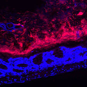 Die Mikrobiota des Darms unter dem Mikroskop. Rot gefärbt sind die Bakterien zu sehen, der Darm  ist blau. 