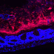 The gut microbiota: our helpful and value guests when the boundaries are respected. The bacteria are red, the intestine is blue.