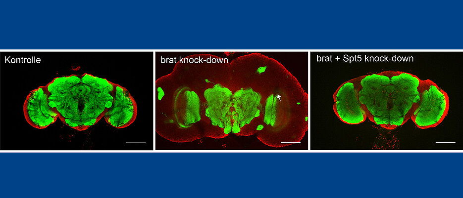 Gehirne von drei Tage alten erwachsenen Fliegen. Links: Gesunde Exemplare. In der Mitte Tiere mit einem Gehirntumor. Rechts: Gehirntumor nach Reduktion der SPT5-Menge. Die grüne Färbung zeigt zentrale Hirnregionen. Rot gefärbt ist die Hirnrinde, der sogenannt Kortex zu sehen, die vom Tumor stark gedehnt wird. 