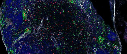 Mikroskop Forschung Immunologie Systemimmunologie Würzburg