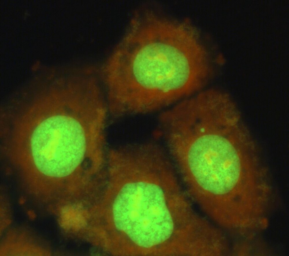 Fluoreszenzfärbung von Zellen