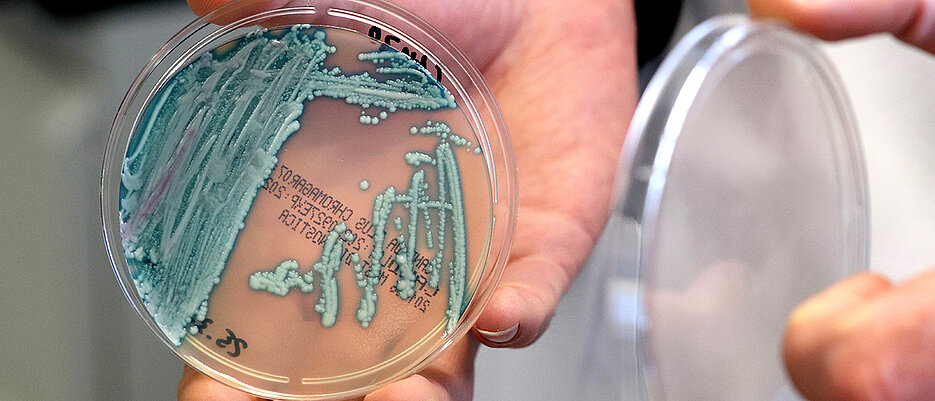 Für gesunde Menschen ist der Pilz in der Regel ungefährlich, bei Menschen mit einem geschwächten Immunsystem oder Patienten auf Intensivstationen ist die Gefahr größer: der Hefepilz Candida auris, hier in der Petrischale gezüchtet, breitet sich in Deutschland aus.