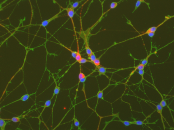 Netzwerke neuronaler Zellen in der Zellkultur