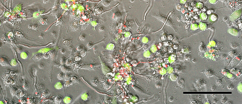 Von Monozyten abgeleitete dendritische Zellen nach einer Infektion mit dem Zytomegalievirus (grün) und dem Schimmelpilz Aspergillus fumigatus (rot). Fluoreszenzmikroskopie, Maßstab 100 µm.