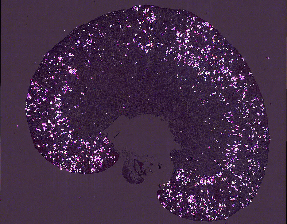 Eine oxalatreiche Ernährung löste bei Mäusen systemische Entzündungen und Herzschäden aus. Im Bild leuchtet das Oxalat als kristallbildender Stoff im polarisierten Licht in der Nierenrinde.