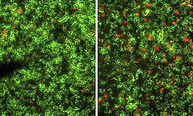 Eine fluoreszenzmikroskopische Aufnahme eines Mauslymphknotens zeigt, dass die Behandlung mit STAR2 (rechts) die Anzahl der regulatorischen T Zellen (rot) deutlich vermehrt. (Foto: A. Beilhack / Uniklinikum Würzburg)
