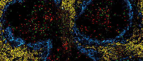 Gesunde (rot) und erschöpfte (grün) T-Zellen in der Milz einer chronisch infizierten Maus.