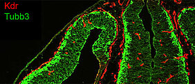 Verteilung von Endothelzellen und neuronalen Zellen im Gehirn der erwachsenen Maus. (Foto: AG Gessler)