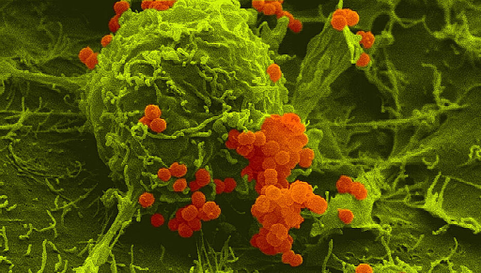 Meningokokken (orange) haben sich an menschliche Wirtszellen (grün) angeheftet. Rasterelektronenmikroskopische Aufnahme in Falschfarbendarstellung.