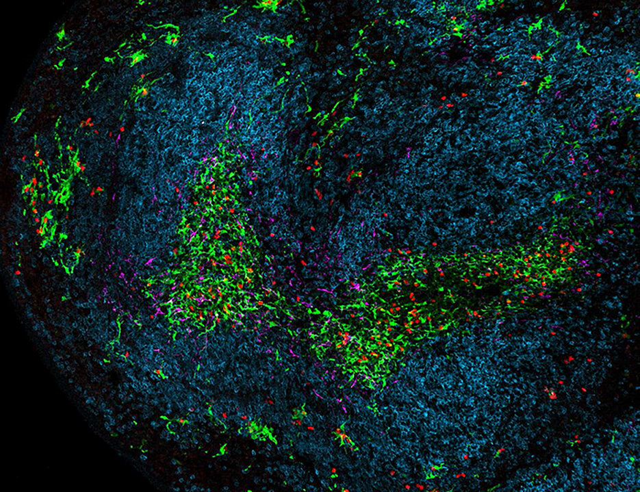 Ein Teil der Milz während einer chronischen Virusinfektion. Dendritische Zellen sind grün, Killer-T-Zellen rot, B-Zellen blau und Stromazellen magenta dargestellt.