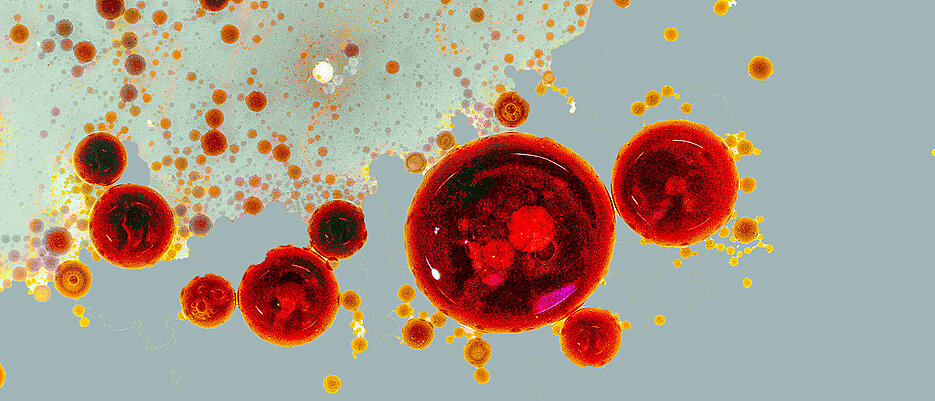 Fotografie einer Vinaigrette: Die Öltropfen symbolisieren die Nanodomänen, die rund um Rezeptoren entstehen. Je nach Signalstärke können die Domänen verschiedene Größen annehmen und auch fusionieren, um dann globale Zellantworten auszulösen.