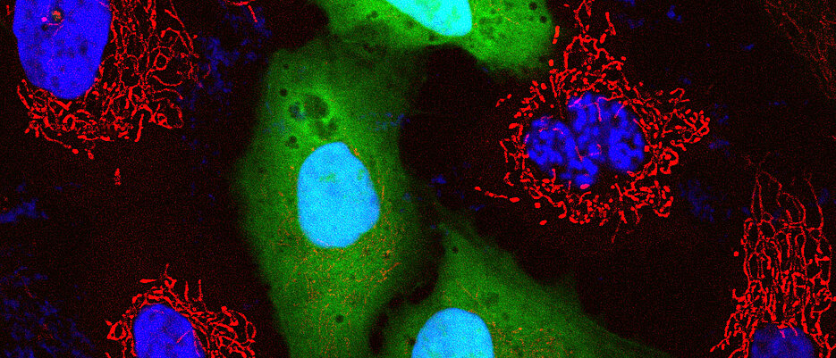 Fluoreszenzkonfokales Bild von kultivierten humanen Zellen. Zu sehen ist die Reaktivierung von HHV-6 (GFP-positive Zellen, grün), die den Verlust von Mitochondrien (rot) verursacht. Die Zellkerne sind blau gefärbt.
