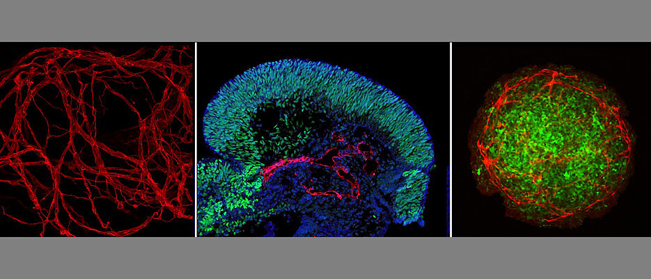 Organoidmodelle mit einer teils verblüffende Ähnlichkeit zu echten embryonalen Geweben. Hier zu sehen sind (v.l.): 3D-Rekonstruktion des Blutgefäßsystems innerhalb eines Organoids, Gehirn-Organoid mit Blutgefäßen (rot) und Gehirnstammzellen (grün) und einTumor-Organoid mit Blutgefäßen (rot) und Tumorzellen (grün). 