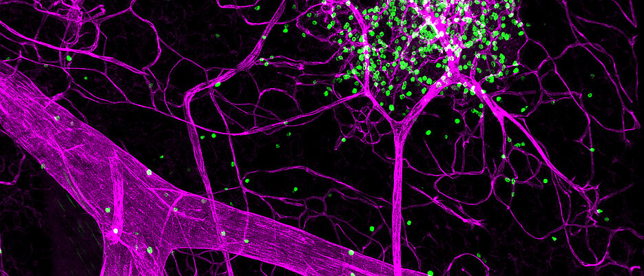 Mikroskopieaufnahme: Das Immunsystem wird in mikroskopischen Strukturen sichtbar – die Wirkung der Forschung auf die Gesundheit ist umso größer. 