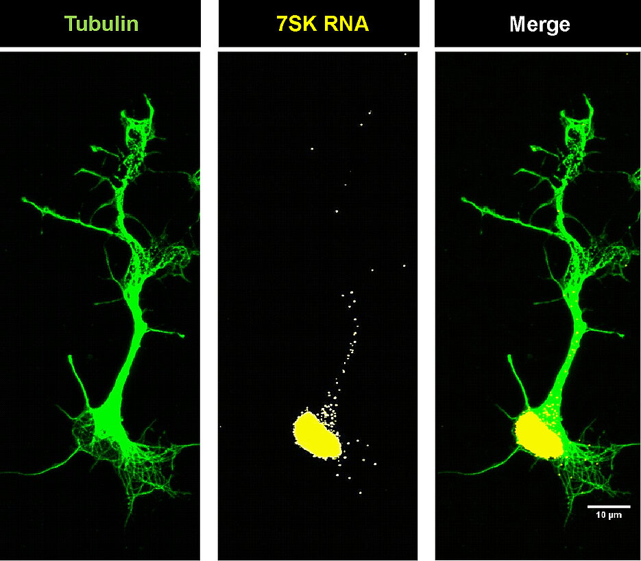 Lokalisation der 7SK-RNA in Motoneuronen, deren Form durch das Strukturprotein Tubulin dargestellt wurde. (Foto: Hanaa Ghanawi)