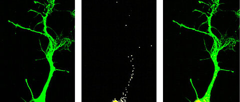 Lokalisation der 7SK-RNA in Motoneuronen, deren Form durch das Strukturprotein Tubulin dargestellt wurde. (Foto: Hanaa Ghanawi)