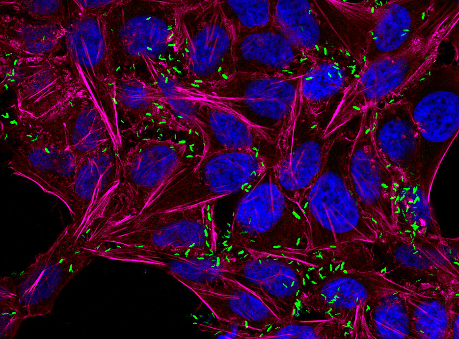 Dieses Fluoreszenz-Mikroskopiebild zeigt Campylobacter jejuni-Bakterien (grün), die menschliche Zellen (HeLa) infiziert haben. Die Zellkerne der menschlichen Wirtszellen sind in blau dargestellt und das Zellskelett (Aktin) in magenta.
