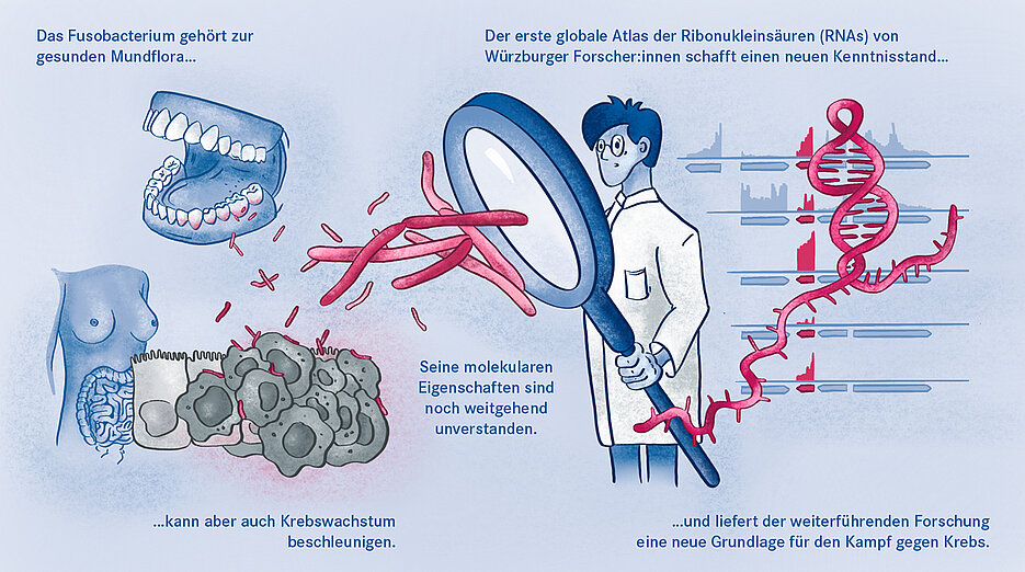 Das Fusobacterium im menschlichen Körper.