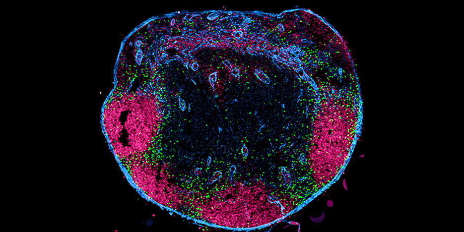 Querschnitt durch einen Lymphknoten. Die unkonventionellen T-Zellen (grün), die über die Lymphbahnen aus dem Gewebe eingewandert sind, befinden sich im Randsinus und in der interfollikulären Zone. Follikuläre B-Zellen sind magenta dargestellt, die Lymphknotenkapsel und lymphatischen Gefäße in blau.