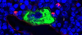 Mikroskopaufnahme von intaktem Knochenmarkgewebe von Mäusen. Im normalen Zustand lagern sich die reifen Megakaryozyten (grün) im Knochenmark an die Gefäßwand (rot) an und geben ihre neuen Blutplättchen zielgerichtet in die Blutbahn ab. Zellkerne sind