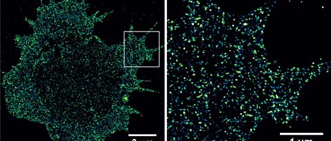 Mit der dSTORM Super-Resolution-Mikroskopie lassen sich Tumor-assoziierte Antigene auf primären Tumorzellen sichtbar machen und quantifizieren. (Bild: AG Markus Sauer)