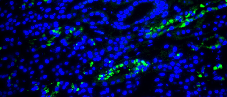 Fluoreszenzaufnahme aus der Nierenbiopsie der DRESS-Patientin