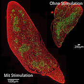 Die feingewebliche Struktur des stimulierten Thymusorgans unterscheidet sich nicht von dem eines unstimulierten Organs. Als Zeichen eines gut funktionierenden Thymus sind die Randbereiche (rot) und Innenzonen (grün) scharf voneinander abgetrennt. 