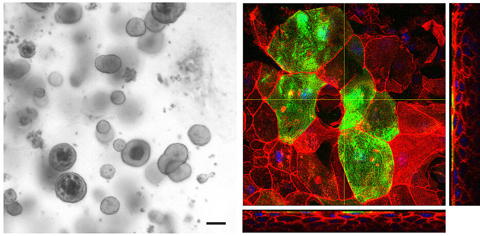 Organoid-basierte Modelle: Blasenorganoide (linkes Bild) werden verwendet, um ein komplexeres, auf Blasenorganoiden basierendes Modell (rechtes Bild) zu entwickeln. Dieses enthält differenzierte oberflächliche Schirmzellen (in grün) und darunter mehrere Zellschichten, was insgesamt das Blasenepithel nachahmt. Uroplakin 3a in grün, Aktin in rot und Zellkerne in blau. 