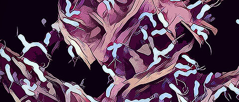 Künstlerische Darstellung von menschlichen Magenzellen, die mit dem Bakterium Helicobacter pylori infiziert sind und die spezielle Hummingbird-Gestalt zeigen.