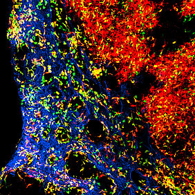 Die Abbildung zeigt die komplexe Organisation von dendritischen Zellen im Lymphknoten. Blau dargestellt sind Blutgefäße. Die grün dargestellten Zellen sind junge dendritische Zellen, wohingegen die rot dargestellten dendritischen Zellen ein paar Tage älter und bereits weitergewandert sind. Die orange dargestellten dendritischen Zellen liegen im Alter dazwischen.