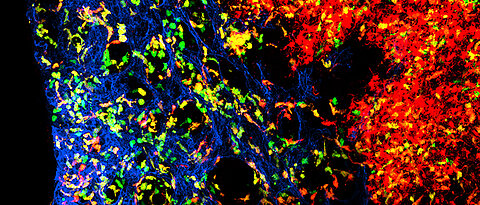 Die Abbildung zeigt die komplexe Organisation von dendritischen Zellen im Lymphknoten. Blau dargestellt sind Blutgefäße. Die grün dargestellten Zellen sind junge dendritische Zellen, wohingegen die rot dargestellten dendritischen Zellen ein paar Tage älter und bereits weitergewandert sind. Die orange dargestellten dendritischen Zellen liegen im Alter dazwischen.